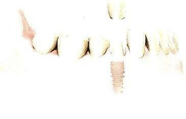 Coroa sobre implante